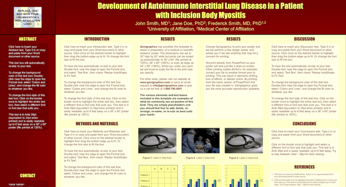 Development of Autoimmune Interstitial Lung Disease in a Patient with Inclusion Body Myositis